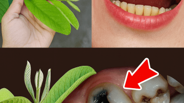 😁 Guava Leaf Dental Magic: 3 Natural Secrets to Transform Your Oral Health