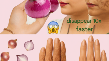 🍃 Papaya Secret: Reverse Gray Hair and Achieve 3-Day Thickness Naturally 🤯