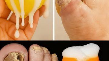 ✨ EL ANTIBIÓTICO OLVIDADO: CÓMO EL AJO ACABA CON 14 TIPOS DE BACTERIAS Y MÁS ✨