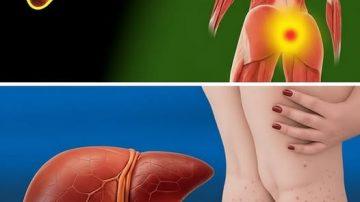 Kalanchoe: El Tesoro Verde que Esconde tu Jardín