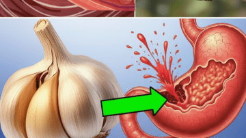 🧄🔥 GARLIC & CLOVES: VENOUS AND JOINT PAIN ERASED 🔥🧄