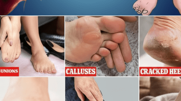 🍌🍋☕ The Limitless Energy Secret: Unlock Peak Performance with the Banana-Lemon-Coffee Elixir!