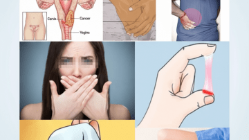 🛑 VIRAL BEAUTY WARNING: The Magic of Lemon Juice and Charcoal—How to Use It Safely (And Why You Must Avoid It for Teeth)