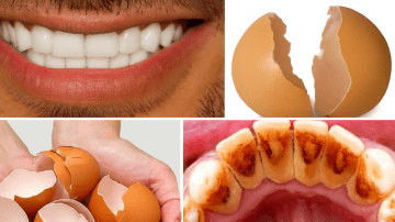 Noticing Small White Spots on Your Arms or Legs? Here’s What You Need to Know About Common Causes