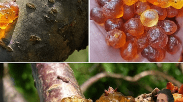 Noticing Small White Spots on Your Arms or Legs? Here’s What You Need to Know About Common Causes