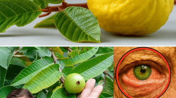 Noticing Small White Spots on Your Arms or Legs? Here’s What You Need to Know About Common Causes