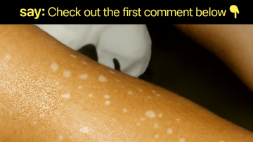 The Potent, Affordable Secret to Stopping Hair Fall and Boosting Growth