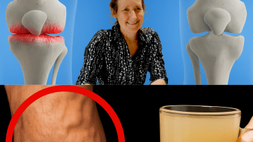 Euphorbia Hirta: The Common Garden Weed That’s 30 Surprising Health Benefits and How to Use It Safely at Home