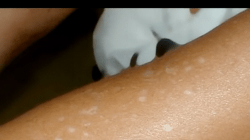 How to Naturally Support Your Kidney Health with a Simple Parsley Herbal Infusion