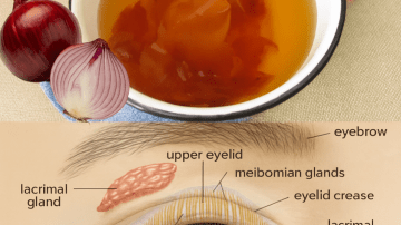 Noticing Small White Spots on Your Arms or Legs? Here’s What You Need to Know About Common Causes