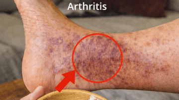 How to Make a Simple Lemon and Ginger Drink at Home for Daily Wellness Support