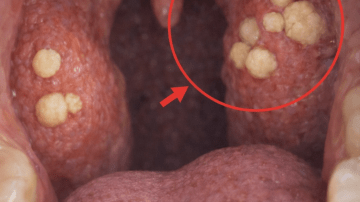 Could Red Onion Be the Simple Kitchen Ingredient Your Skin Routine Is Missing? A Guide to Exploring Its Potential Benefits