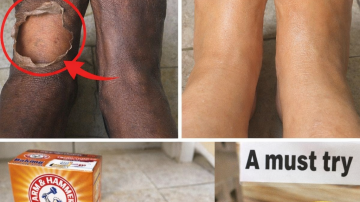 Discover the Top 10 Drinks That Could Support Your Kidney Health and Help Manage Proteinuria Symptoms Naturally