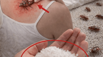 How to Naturally Improve the Appearance of Dry, Discolored, and Aging Legs at Home