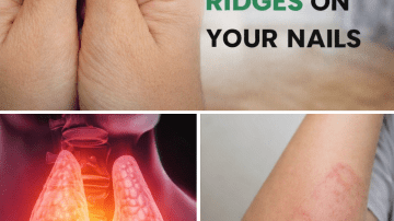 A Simple Morning Ritual: Why Many Women Over 45 Are Starting Their Day with Warm Clove, Cinnamon, Bay Leaf, and Ginger Tea