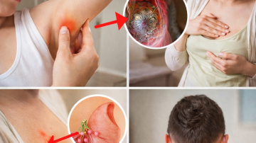 🌿 Transform Your Hair with This Homemade Aloe Vera and Rosemary Shampoo: Stop Hair Loss and Boost Growth Naturally