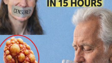 Natural Ways to Support Joint Comfort Using Banana, Onion, and Turmeric from Your Kitchen