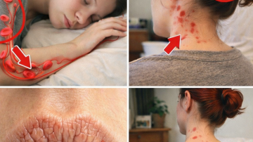 Can Cloves Help Support Healthy Nails When Dealing with Fungal Issues?