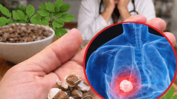 12 Subtle Signs of Pancreatic Cancer That Are Easy to Overlook