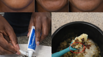 10 Fruits That May Support Kidney Health Naturally: A Helpful Guide for Everyday Choices