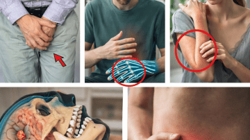 Can 10 Everyday Superfoods Help Support Kidney Health and Manage Protein in Urine?