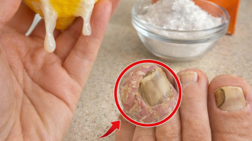 How to Make a Simple Kidney-Supporting Detox Juice at Home Naturally