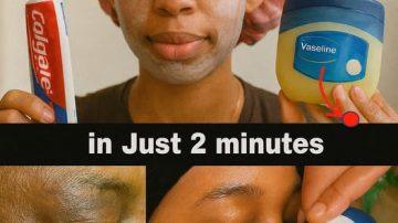 How to Explore Garlic and Clove Oil as a Home Remedy for Better Leg Comfort and Circulation