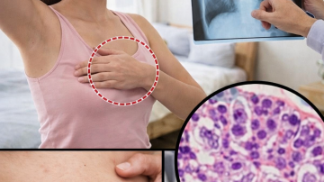 🌿 Cyperus Rotundus Superherb: 8 Hidden Health Powers Revolutionizing Wellness