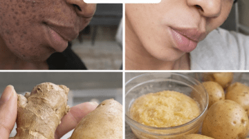 👑 The Golden Threads: 30 Astonishing Health Benefits of Corn Silk (Nature’s Hidden Kidney Treasure)