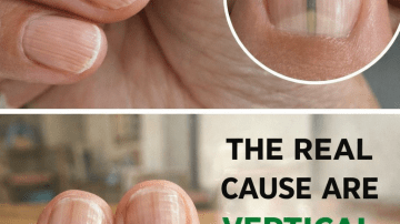 Discover the Vitamin That Could Help Support Blood Circulation in Legs and Feet After 50