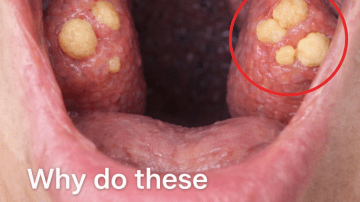 What Is Crowfoot Grass and Why Does It Make Your Skin Itch Like Crazy? (A Complete Guide)