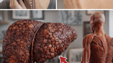 Natural Ways to Support Joint Comfort Using Banana, Onion, and Turmeric from Your Kitchen