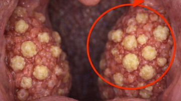 🦵 Unlock the Secret to Stronger Knees: The Surprising Foods That Protect Your Joints