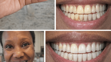 👑 The Zero-Chemical Accelerator: Unlock 2X Hair Growth and Density with This Ancient 6-Herb Oil Elixir