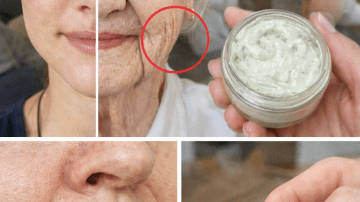 Can Cloves Help Support Healthy Nails When Dealing with Fungal Issues?