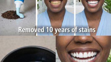 🚀 THE GROWTH CATALYST: Cloves and Rosemary Water for Massive Hair Growth and Thicker Hair