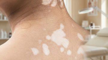 Discover 6 Nutrient-Rich Seeds That May Boost Your Body’s Natural Defenses Against Cancer Risks