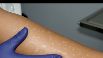 Discover How to Prepare and Use Onion Water as a Natural Hair Care Option at Home