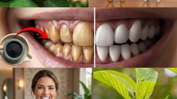 Which Nuts Should You Limit for Better Kidney Health? 3 to Avoid and 3 Smarter Choices