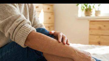 What Is Crowfoot Grass and Why Does It Make Your Skin Itch Like Crazy? (A Complete Guide)