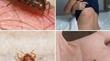 How to Handle Heart Attack Symptoms When Alone After Age 60: 7 Practical Steps for Seniors