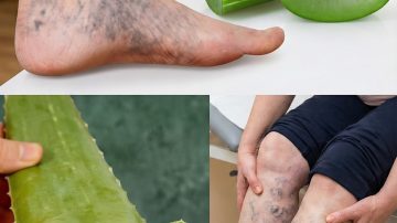 10 Early Warning Signs of Breast Cancer Every Woman Should Know in 2025