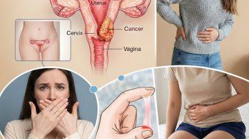 Discover Why Those Small Foul-Smelling White Stones Appear in Your Mouth and How to Handle Them