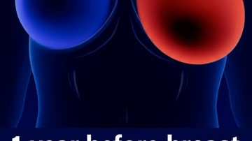 12 Superfoods That May Support Kidney Health and Help Maintain Healthy Creatinine Levels