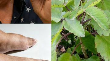 ¿Por qué tu intestino se “atoró” de repente?