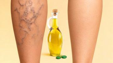 👣 ¡Adiós a los Hongos! El Remedio Casero Antimicótico que Transformará tus Pies y Uñas