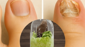 El Remedio de la Abuela para Piernas de Seda: Sábila, Vinagre y Limón contra las Várices 🍋