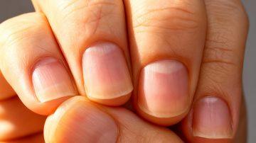 Dandelion Tea: Nature’s Secret to a Healthy Liver and Gut