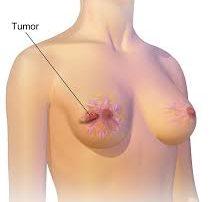 Discover the Surprising Ways Papaya Seeds Can Support Your Daily Wellness Routine