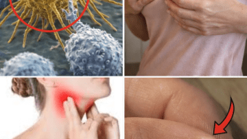 What Are the Subtle Body Changes That Could Point to Pancreatic Health Concerns?